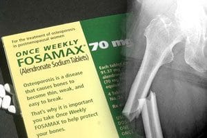 how long does fosamax stay in bones