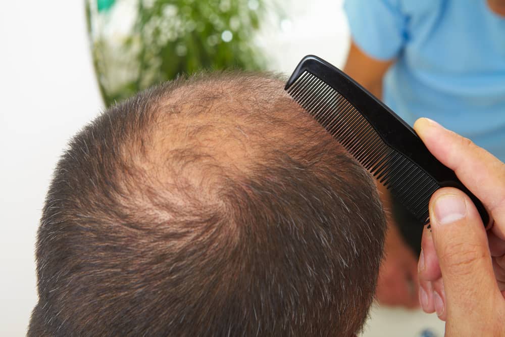 can the drug losartan cause hair loss