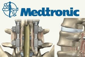 medtronic infuse lawsuits growth